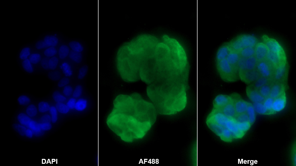 前梯度蛋白2(AGR2)多克隆抗體