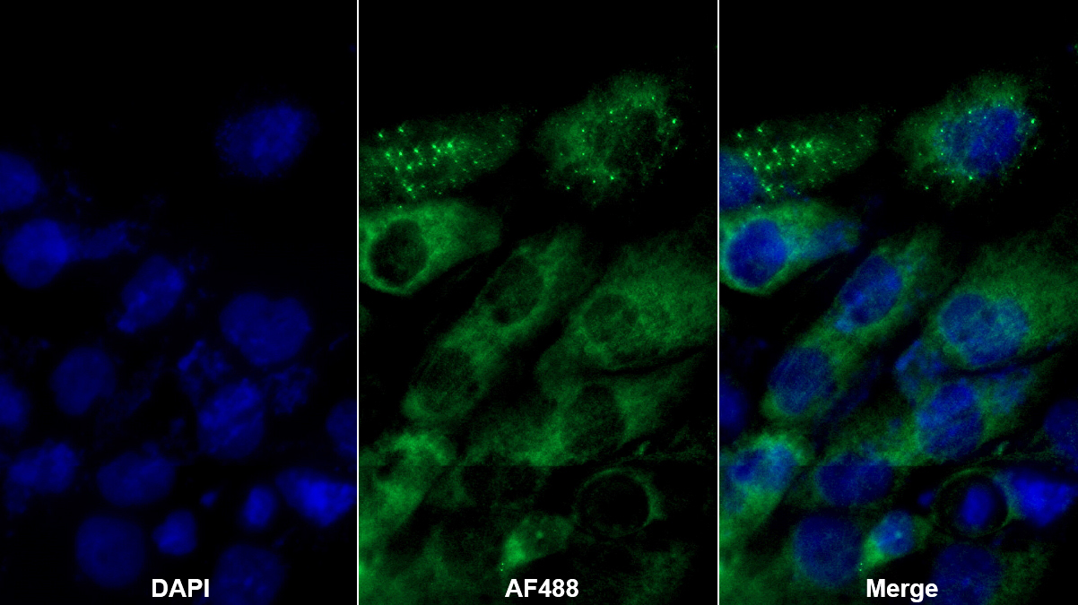 中腦星形膠質細胞來源神經營養(yǎng)因子(MANF)多克隆抗體