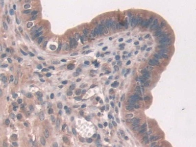 無孢蛋白(ASPN)多克隆抗體