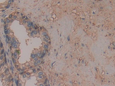 膜联蛋白A6(ANXA6)多克隆抗体