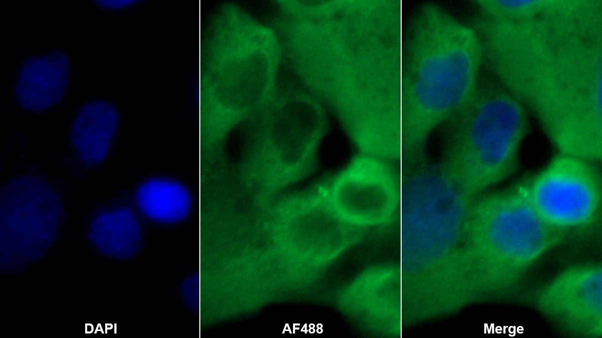 鈣周期素結(jié)合蛋白(CACYBP)多克隆抗體