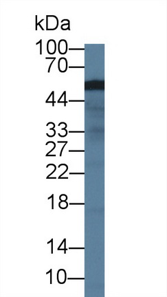 钙激活核苷酸酶1(CANT1)多克隆抗体