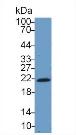 染色框同源物3(CBX3)多克隆抗体