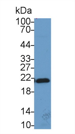 染色框同源物3(CBX3)多克隆抗体