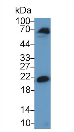 染色框同源物3(CBX3)多克隆抗体