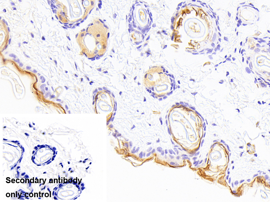 角化粒素(CDSN)多克隆抗體