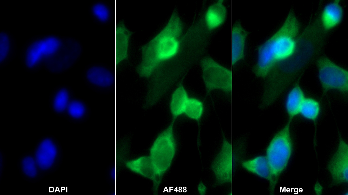 坍塌應答調停蛋白1(CRMP1)多克隆抗體