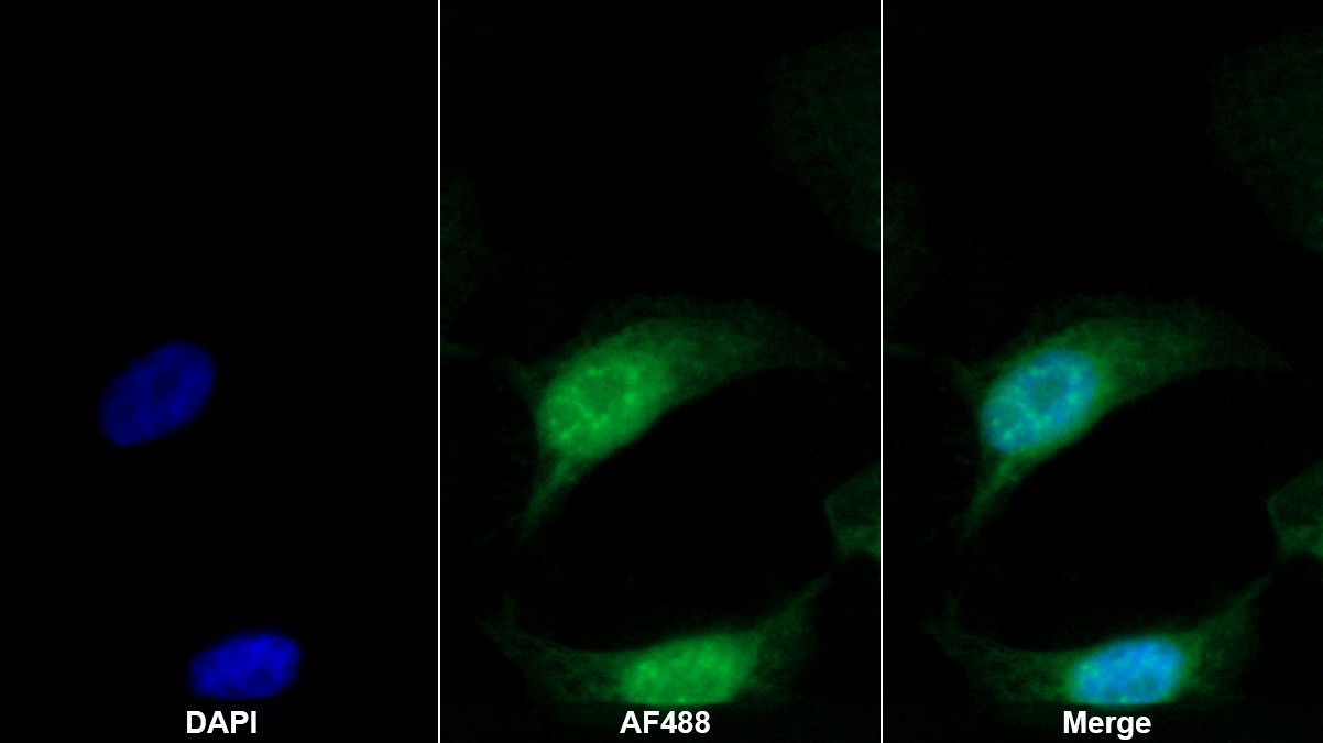順鉑耐藥結(jié)合過表達(dá)蛋白(CROP)多克隆抗體