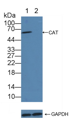 過氧化氫酶(CAT)多克隆抗體