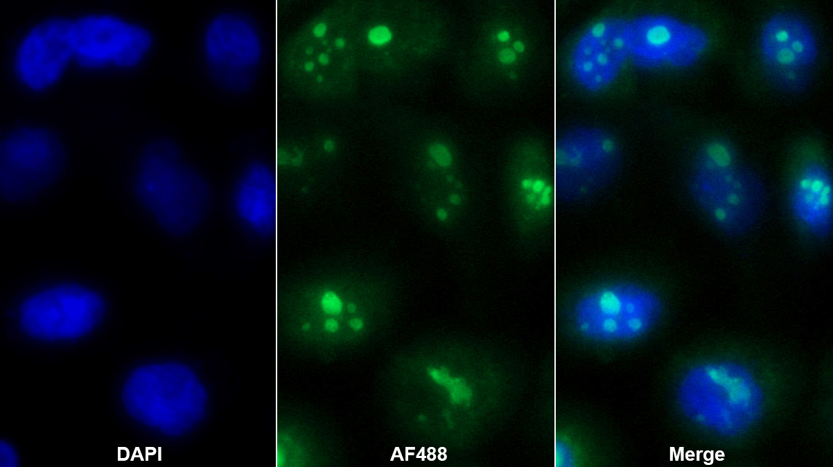 角化不良蛋白(DKC)多克隆抗體