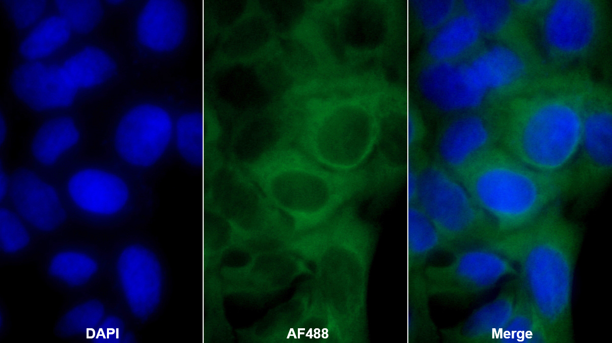 肌營養(yǎng)不良蛋白關(guān)聯(lián)糖蛋白1(DAG1)多克隆抗體
