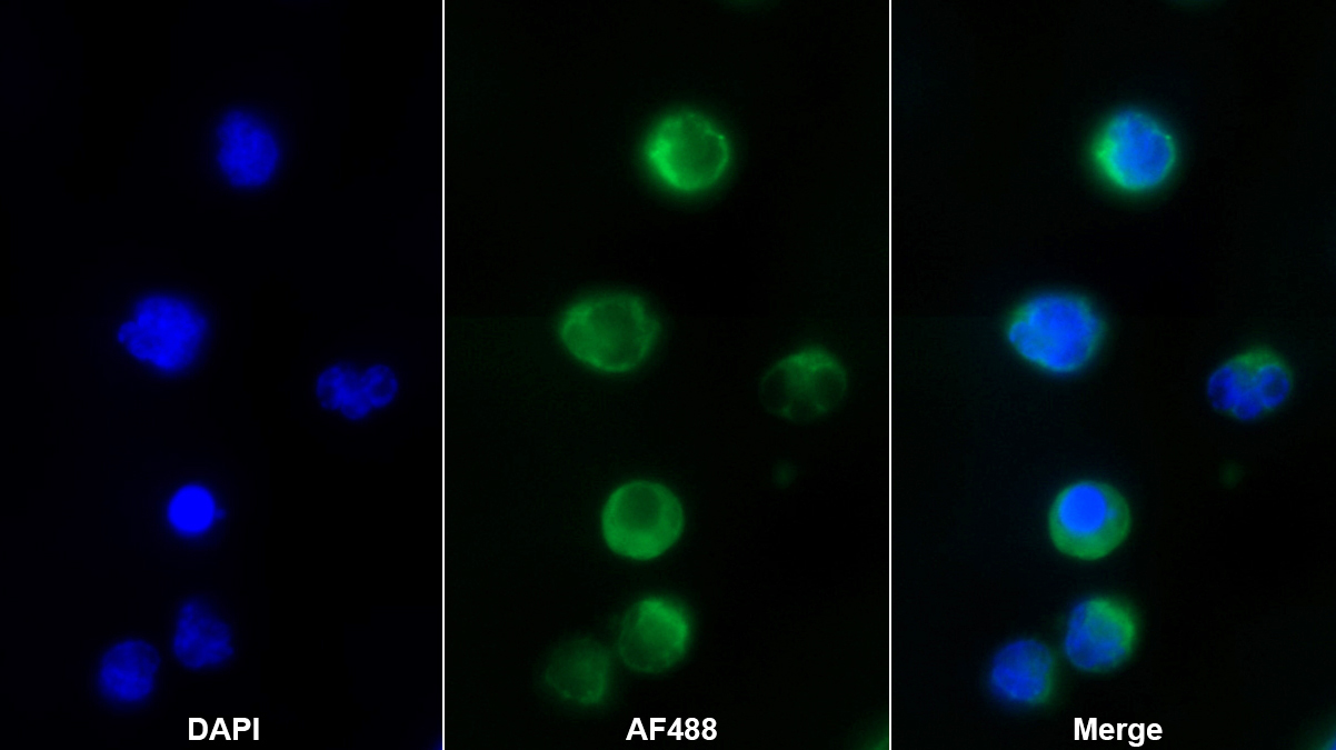 巖藻糖-1-磷酸鳥(niǎo)苷酰轉(zhuǎn)移酶(FPGT)多克隆抗體