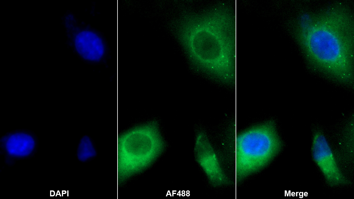 亞鐵螯合酶(FECH)多克隆抗體