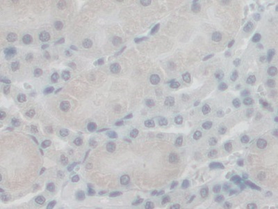 线粒体G延伸因子1(GFM1)多克隆抗体