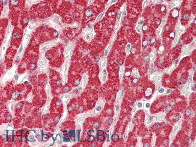 葡萄糖腦苷脂酶(GBA)多克隆抗體