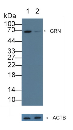 顆粒體蛋白(GRN)多克隆抗體