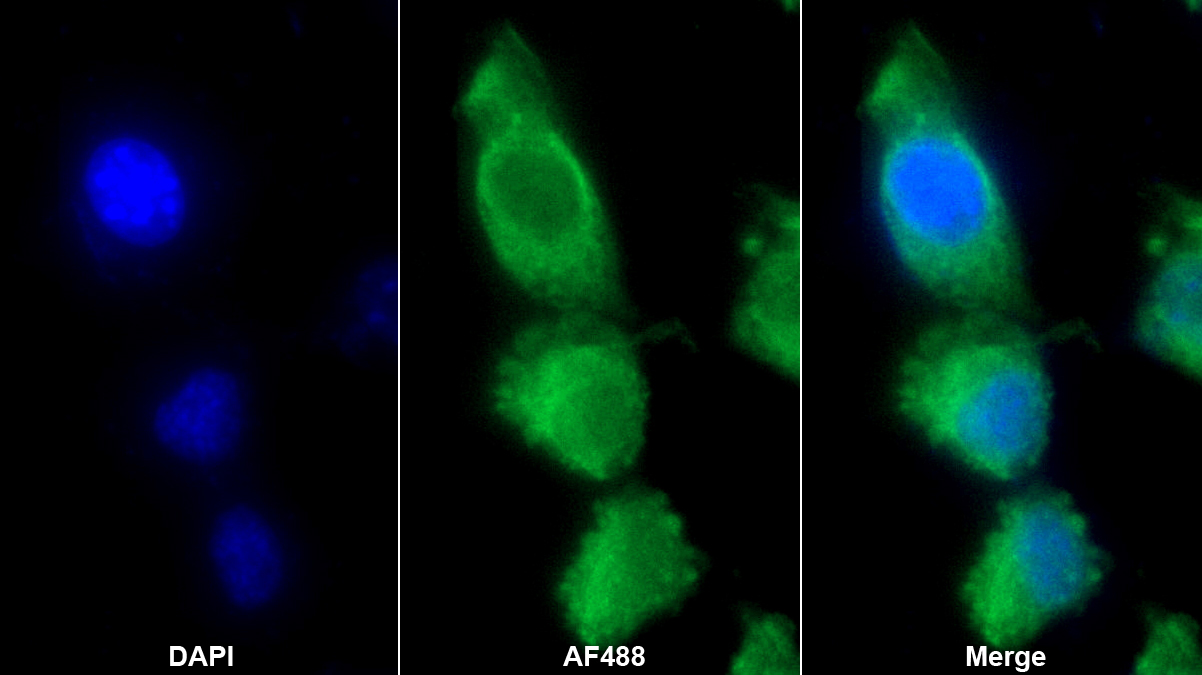 組氨酸豐富糖蛋白(HRG)多克隆抗體
