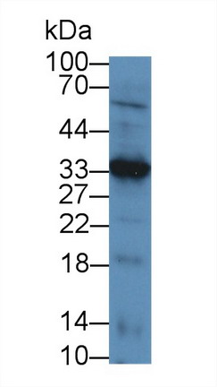 白细胞衍生趋化因子1(LECT1)多克隆抗体
