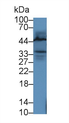 白细胞衍生趋化因子1(LECT1)多克隆抗体