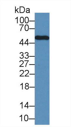 淋巴細(xì)胞特異性蛋白1(LSP1)多克隆抗體