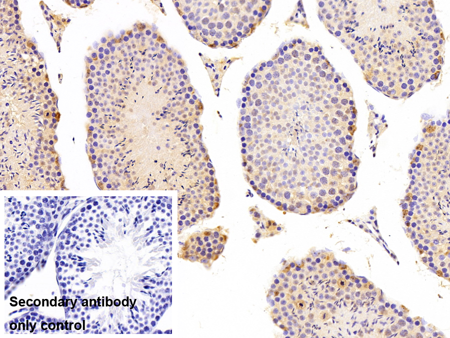 牛痘相關激酶1(VRK1)多克隆抗體
