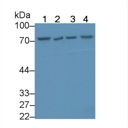 Zuotin相關(guān)因子1(ZRF1)多克隆抗體