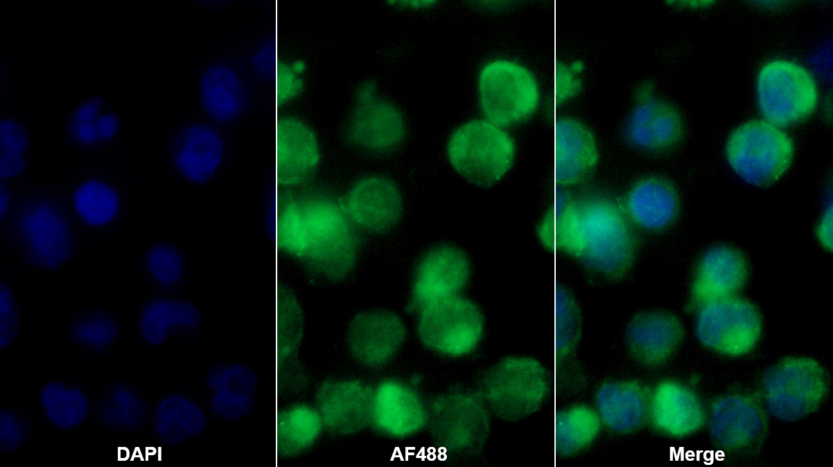多聚蛋白1(MMRN1)多克隆抗体