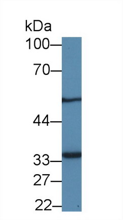 Metaxin 1蛋白(MTX1)多克隆抗体