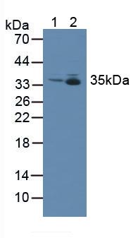 Metaxin 1蛋白(MTX1)多克隆抗体