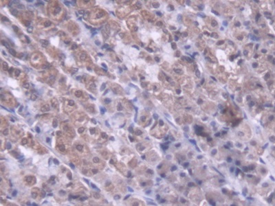 Metaxin 1蛋白(MTX1)多克隆抗体