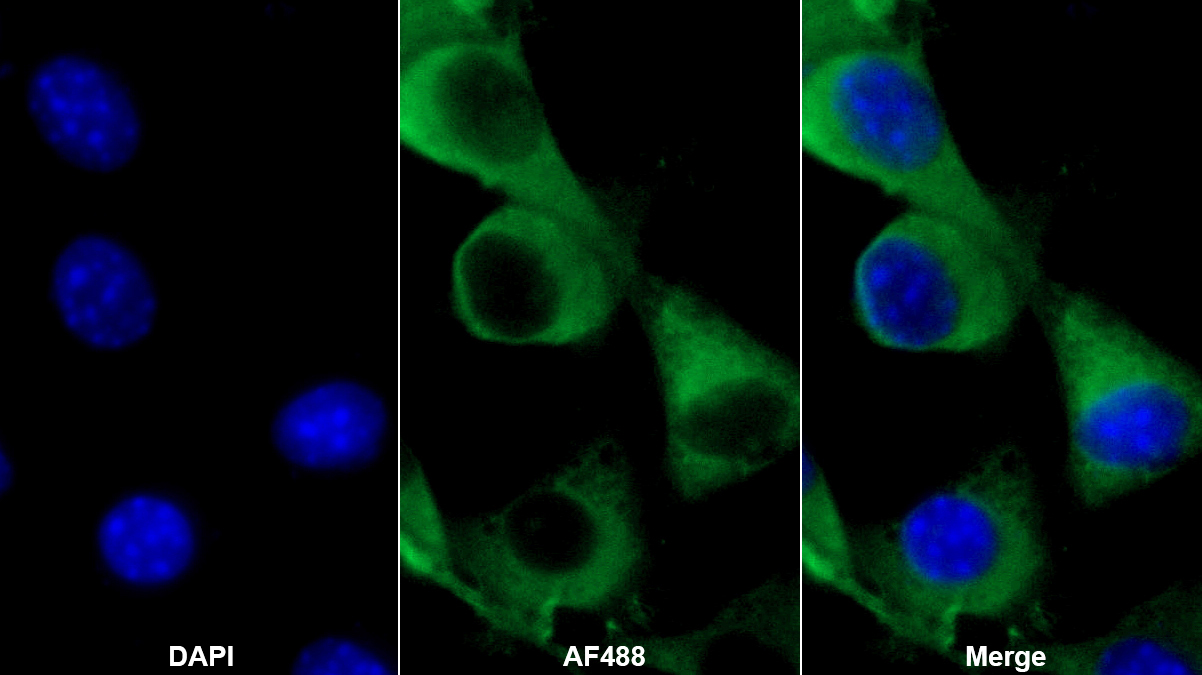 膜突蛋白(MSN)多克隆抗體