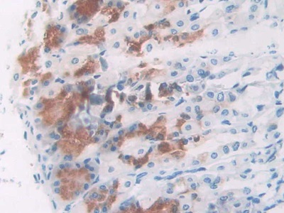 核仁磷酸蛋白(NPM1)多克隆抗体