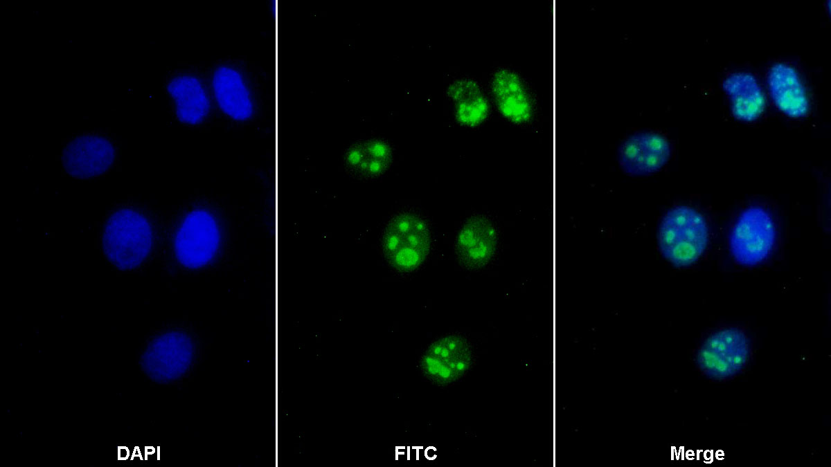 核仁磷酸蛋白(NPM1)多克隆抗体