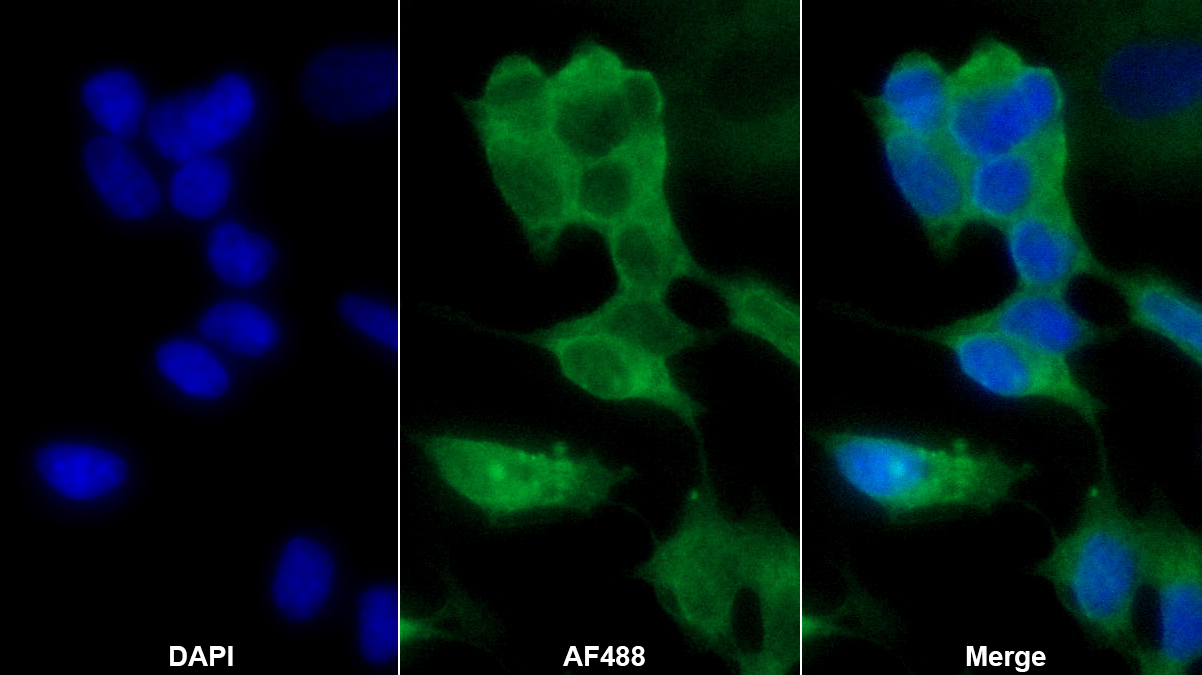 神经细胞粘附分子(NRCAM)多克隆抗体