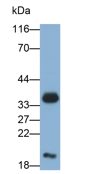 8-羥基鳥嘌呤糖苷酶1(OGG1)多克隆抗體