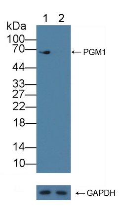 葡萄糖磷酸变位酶1(PGM1)多克隆抗体