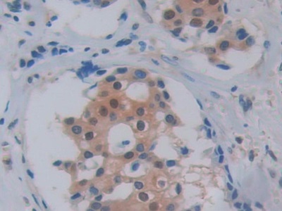胰腺特異轉錄因子1α(PTF1a)多克隆抗體