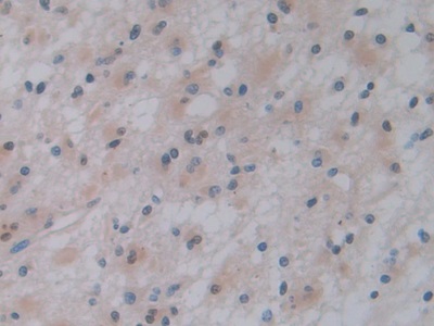 胰腺特異轉錄因子1α(PTF1a)多克隆抗體