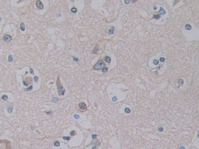 胰腺特異轉錄因子1α(PTF1a)多克隆抗體