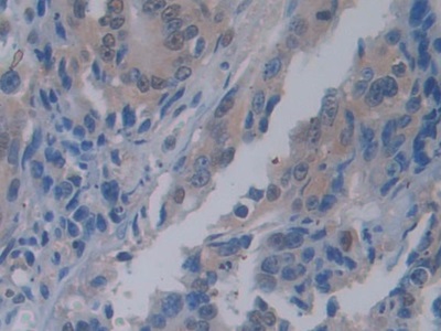 胰腺特異轉錄因子1α(PTF1a)多克隆抗體