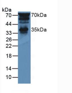 胰腺特异转录因子1α(PTF1a)多克隆抗体