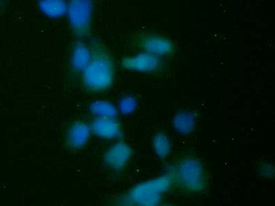 胰腺特异转录因子1α(PTF1a)多克隆抗体