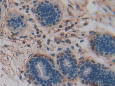 胰腺特异转录因子1α(PTF1a)多克隆抗体