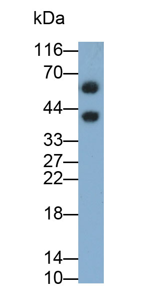 胰腺特异转录因子1α(PTF1a)多克隆抗体