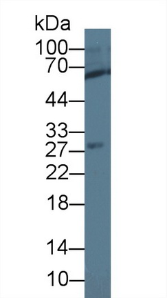 垂体肿瘤转化蛋白1(PTTG1)多克隆抗体