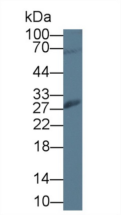 垂体肿瘤转化蛋白1(PTTG1)多克隆抗体