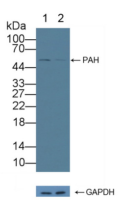 苯丙氨酸羟化酶(PAH)多克隆抗体