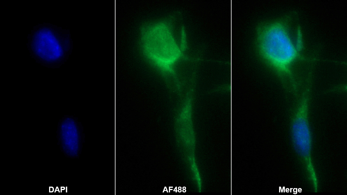 鈣調(diào)素(RGN)多克隆抗體