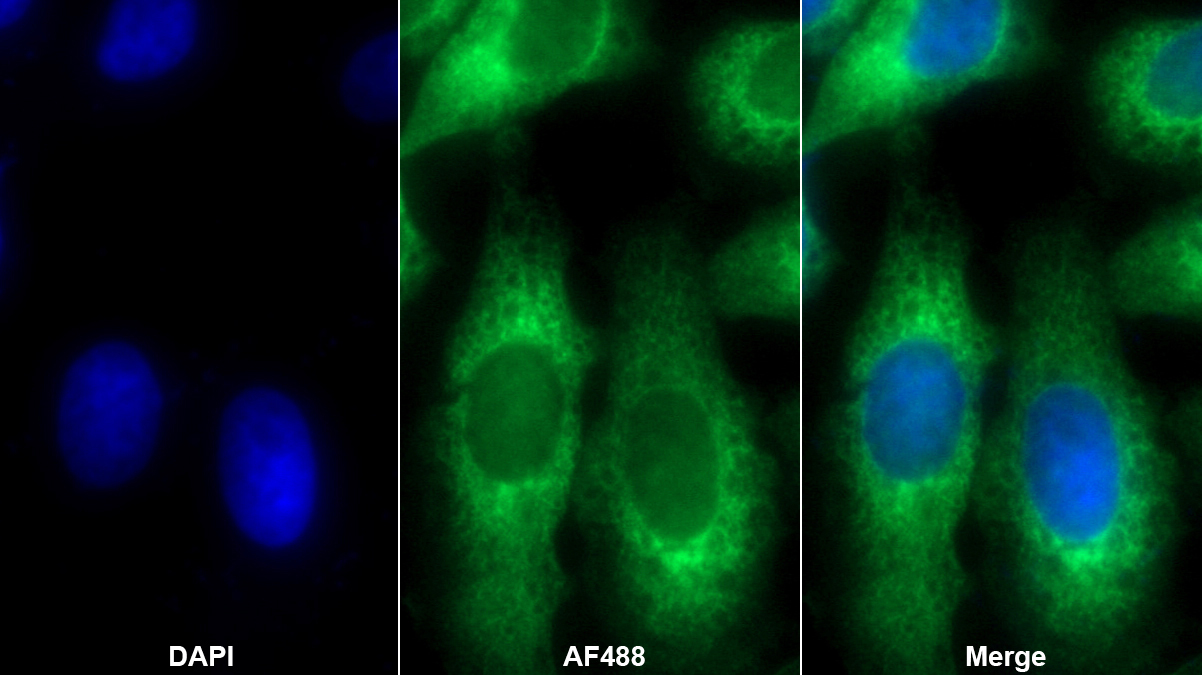 核糖体结合蛋白1(RRBP1)多克隆抗体