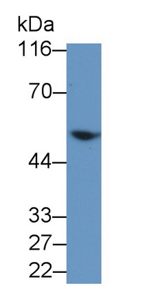 跨膜丝氨酸蛋白酶2(TMPRSS2)多克隆抗体